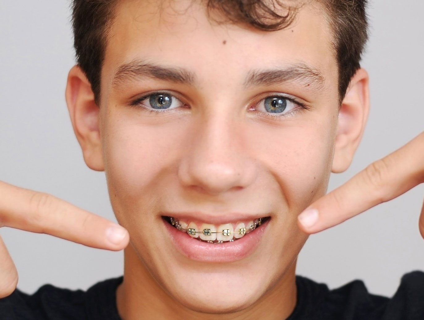 dentistas especializados en implantes ortodoncia brackets aparato