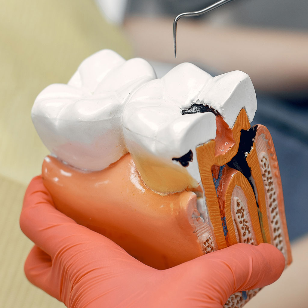 empaste en mavilo especialistas en implantes