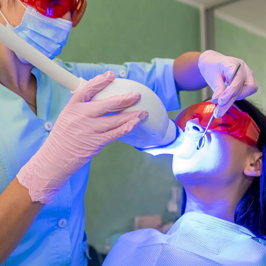 estetica dental mavilo blanqueamiento