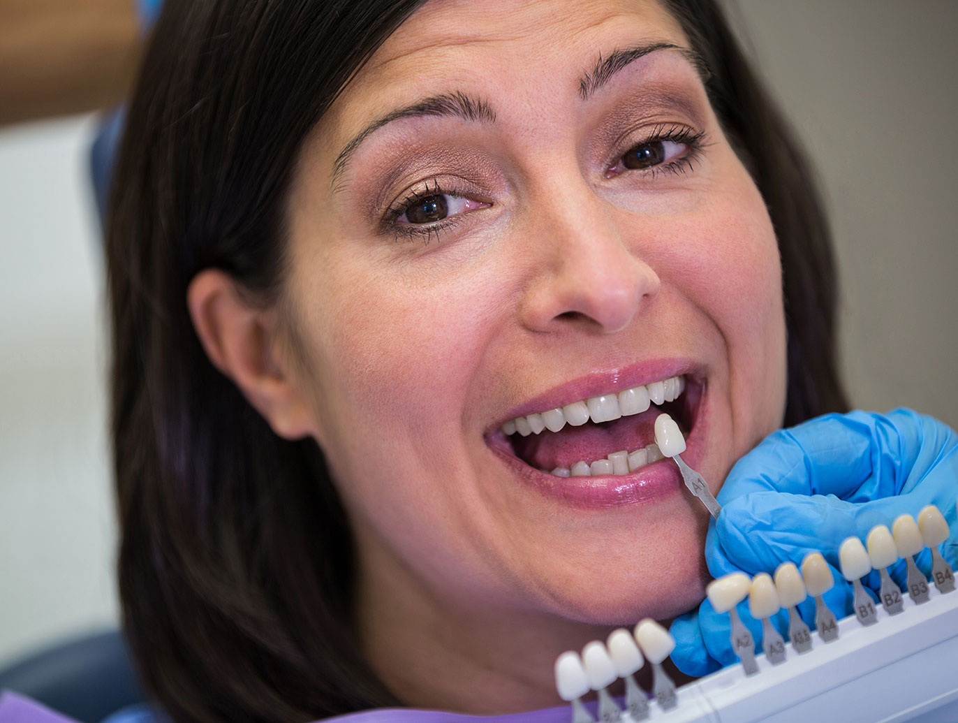 empaste en mavilo especialistas en implantes